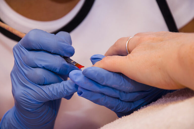 Nail fungal infection – Causes, symptoms, and management