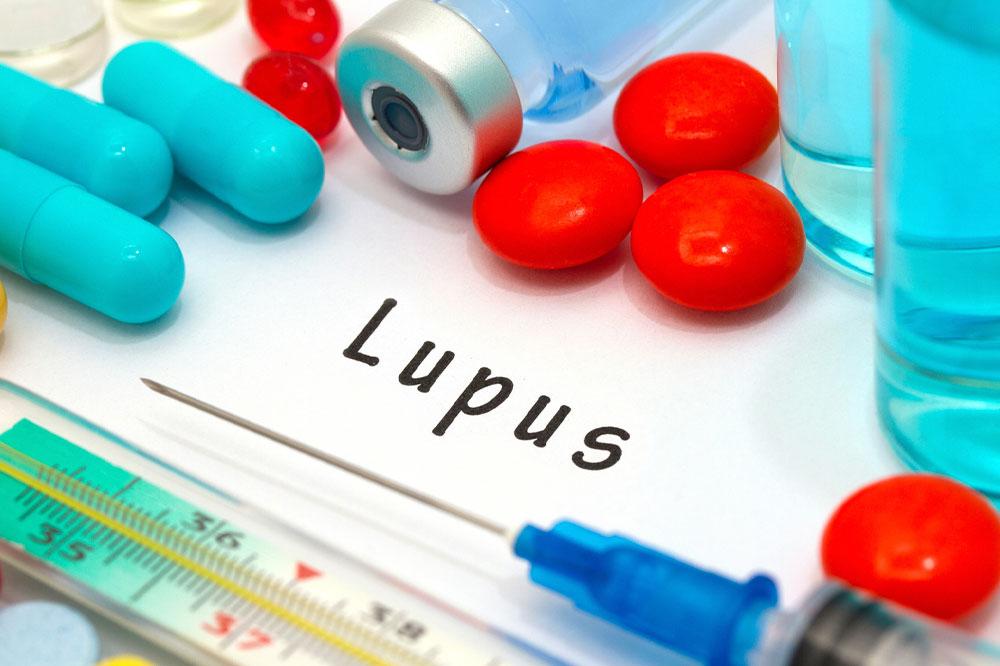 Lupus – Symptoms, Risk Factors, and Diagnosis